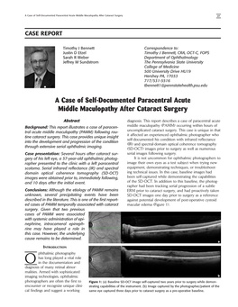 A Case of Self-Documented Paracentral Acute Middle Maculopathy After Cataract Surgery 27