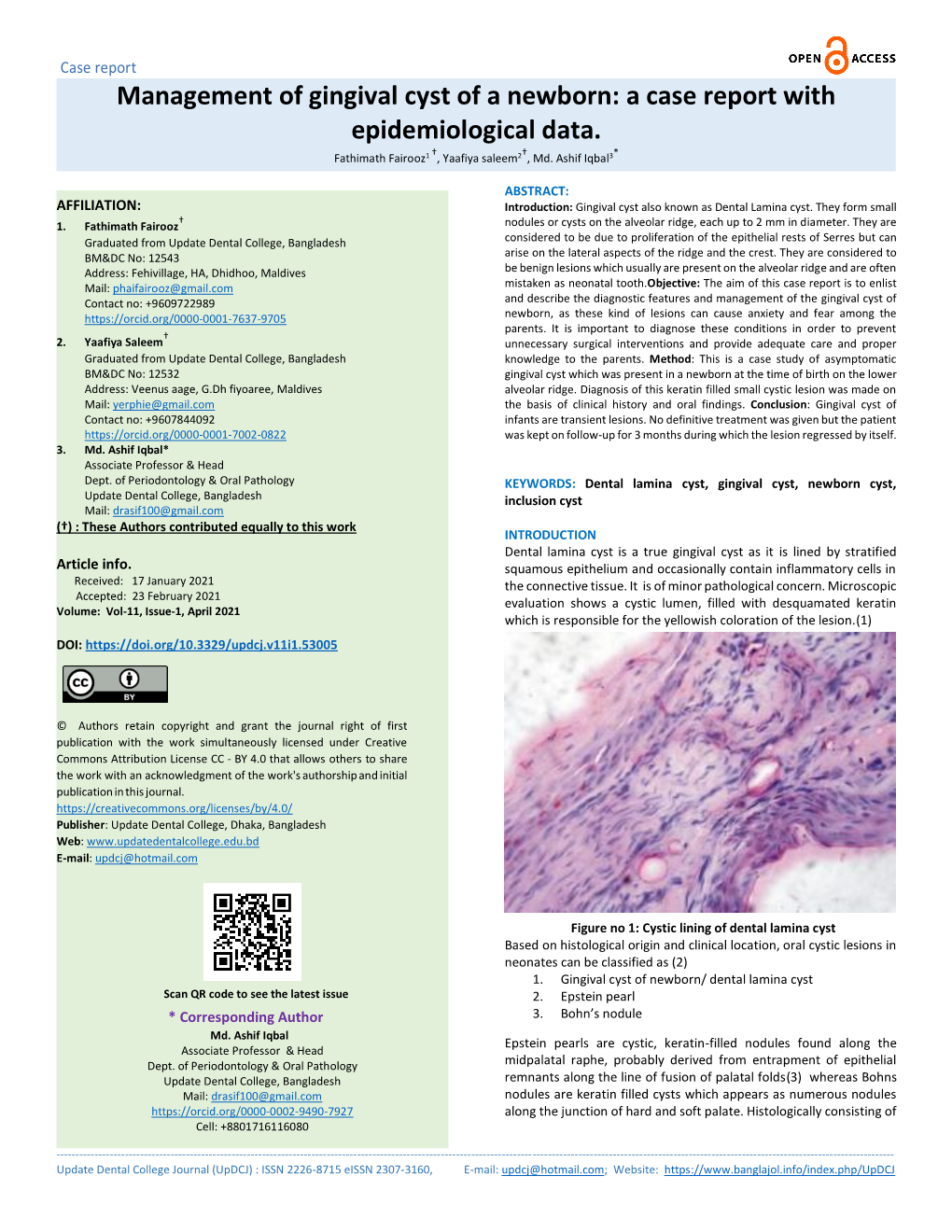 Management of Gingival Cyst of a Newborn: a Case Report with Epidemiological Data. Fathimath Fairooz1 †, Yaafiya Saleem2†, Md