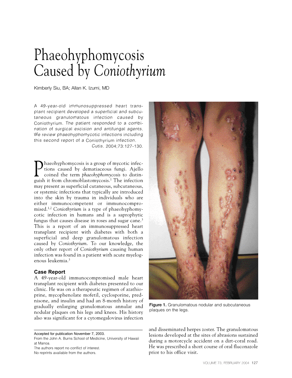 Phaeohyphomycosis Caused by Coniothyrium