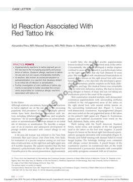 Id Reaction Associated with Red Tattoo Ink