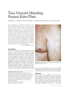 Tinea Versicolor Mimicking Pityriasis Rubra Pilaris