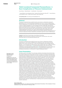 Multi-Loculated Catamenial Pneumothorax: a Rare Complication of Thoracic Endometriosis