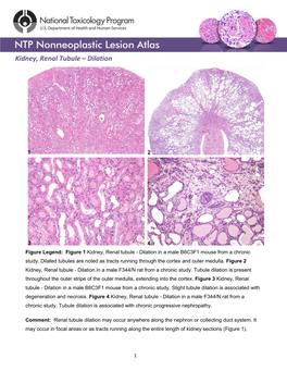 Kidney, Renal Tubule – Dilation