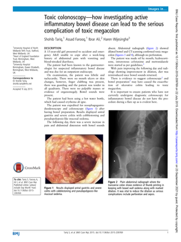 Toxic Colonoscopy—How Investigating Active Inflammatory Bowel Disease