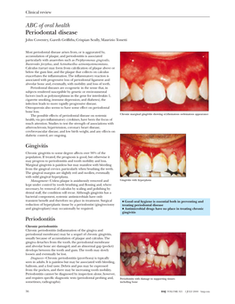 ABC of Oral Health Periodontal Disease John Coventry, Gareth Griffiths, Crispian Scully, Maurizio Tonetti
