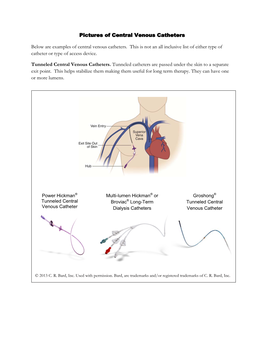 Pictures of Central Venous Catheters