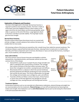 Patient Education Total Knee Arthroplasty