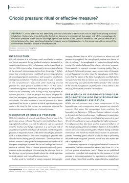 Cricoid Pressure: Ritual Or Effective Measure?