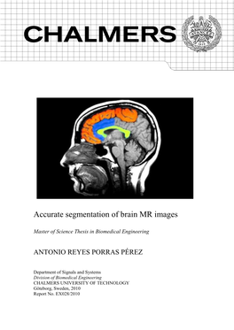 Accurate Segmentation of Brain MR Images