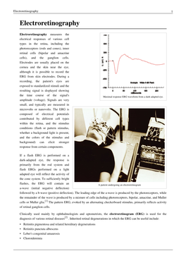 Electroretinography 1 Electroretinography