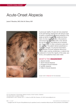 Acute-Onset Alopecia