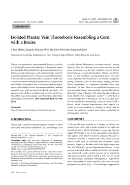 Isolated Plantar Vein Thrombosis Resembling a Corn with a Bruise