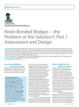 Resin-Bonded Bridges − the Problem Or the Solution?: Part 1 Assessment and Design