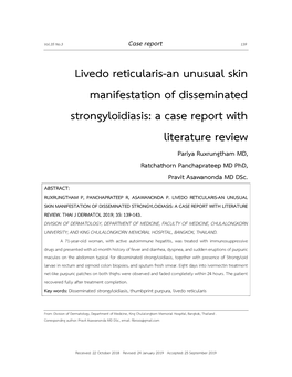 Livedo Reticularis-An Unusual Skin Manifestation of Disseminated