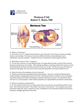 Meniscus FAQ Robert T. Bents, MD