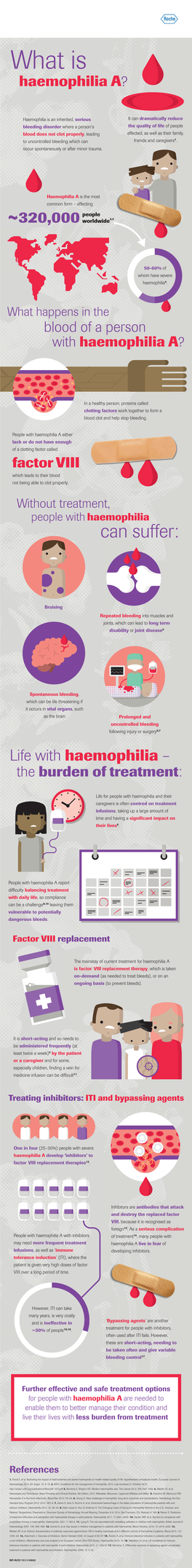 Haemophilia a Is the Most Common Form – Affecting