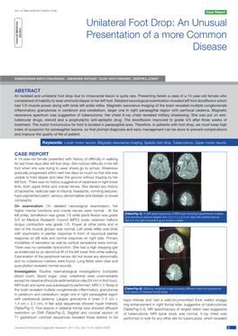 Unilateral Foot Drop: an Unusual Presentation of a More Common