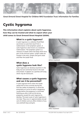 Cystic Hygroma