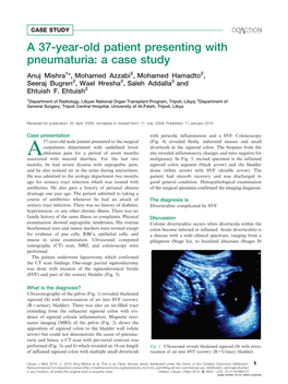 A 37-Year-Old Patient Presenting with Pneumaturia: a Case Study