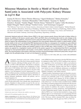 Missense Mutation in Sterile Motif of Novel Protein Samcystin Is