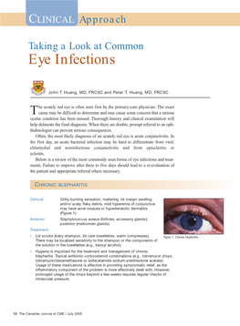 Eye Infections