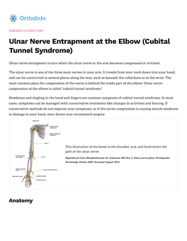 Cubital Tunnel Syndrome)