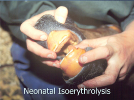 Neonatal Isoerythrolysis Neonatal Isoerythrolysis Pathogenesis