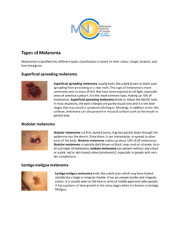 Types of Melanoma