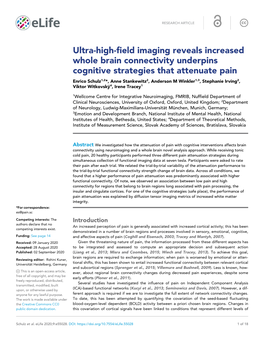 Ultra-High-Field Imaging Reveals Increased Whole Brain Connectivity