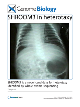 SHROOM3 Is a Novel Candidate for Heterotaxy Identified by Whole Exome Sequencing Tariq Et Al