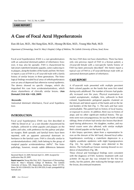 A Case of Focal Acral Hyperkeratosis