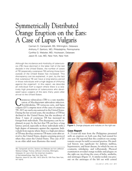 A Case of Lupus Vulgaris Carmen D