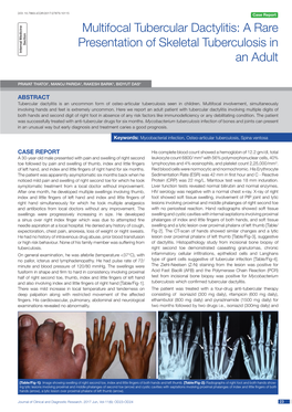 Multifocal Tubercular Dactylitis: a Rare Case Series