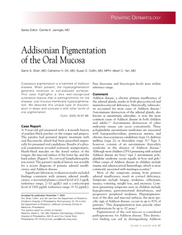 Addisonian Pigmentation of the Oral Mucosa