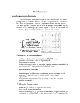 Young Adults. Look for ST Elevation, Tall QRS Voltage, 