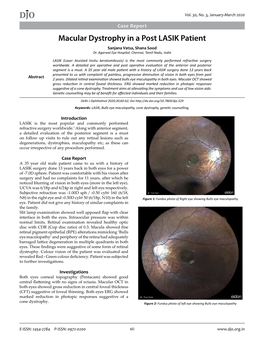 DJO Macular Dystrophy in a Post LASIK Patient