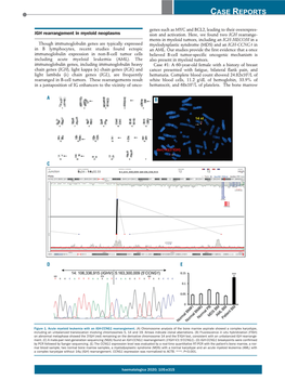 IGH Rearrangement in Myeloid Neoplasms Sion and Activation