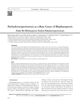 Pachydermoperiostosis As a Rare Cause of Blepharoptosis Nadir Bir Blefaroptozis Nedeni Pakidermoperiostozis
