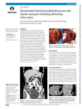 Disseminated Intestinal Basidiobolomycosis with Mycotic