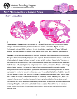 Ovary – Angiectasis