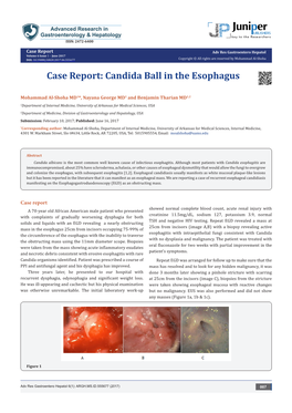 Candida Ball in the Esophagus