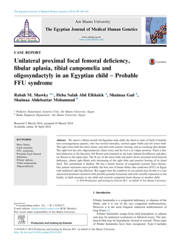 Unilateral Proximal Focal Femoral Deficiency, Fibular Aplasia, Tibial