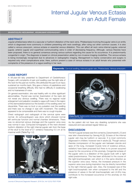 Internal Jugular Venous Ectasia in an Adult Female Surgery Section