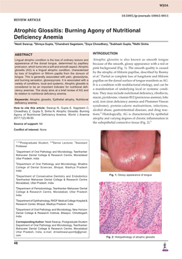 Atrophic Glossitis: Burning Agony of Nutritional Deficiency Anemia 1Neeti Swarup, 2Shreya Gupta, 3Chandrani Sagolsem, 4Zoya Chowdhary, 5Subhash Gupta, 6Nidhi Sinha