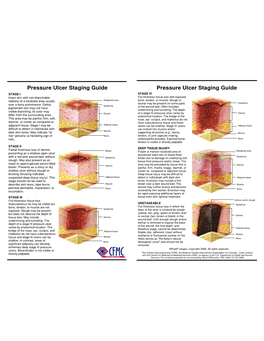 Pressure Ulcer Staging Guide