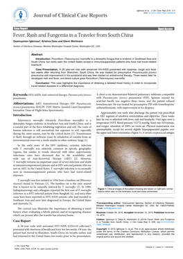 Fever, Rash and Fungemia in a Traveler from South China Osamuyimen Igbinosa*, Krishna Dass and Glenn Wortmann