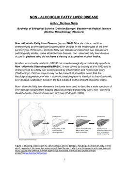 Non - Alcoholic Fatty Liver Disease