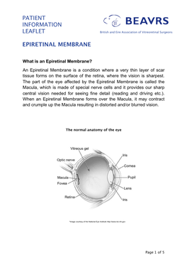 Epiretinal Membrane