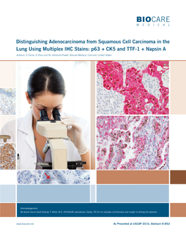 Distinguishing Adenocarcinoma from Squamous Cell Carcinoma in the Lung Using Multiplex IHC Stains: P63 + CK5 and TTF-1 + Napsin