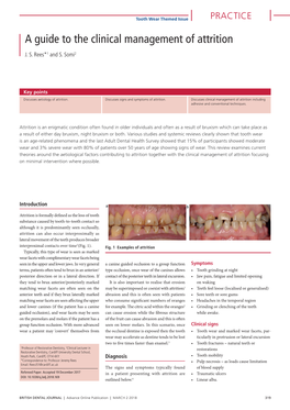 A Guide to the Clinical Management of Attrition